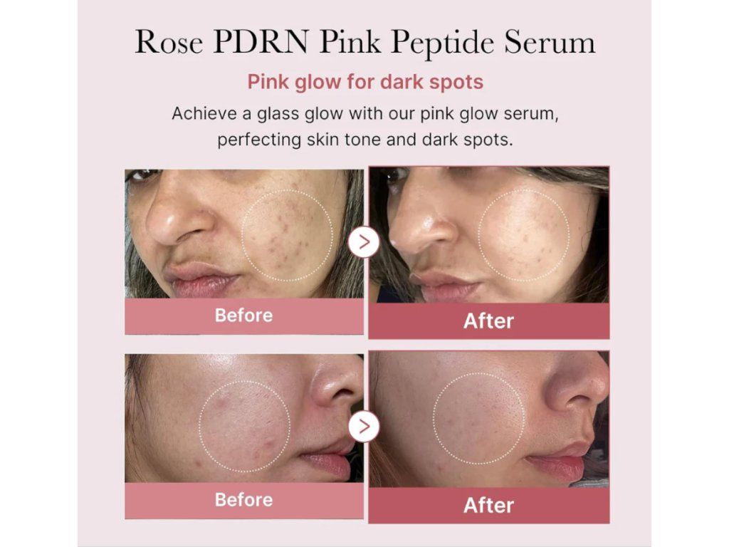 PDRN korejská skincare